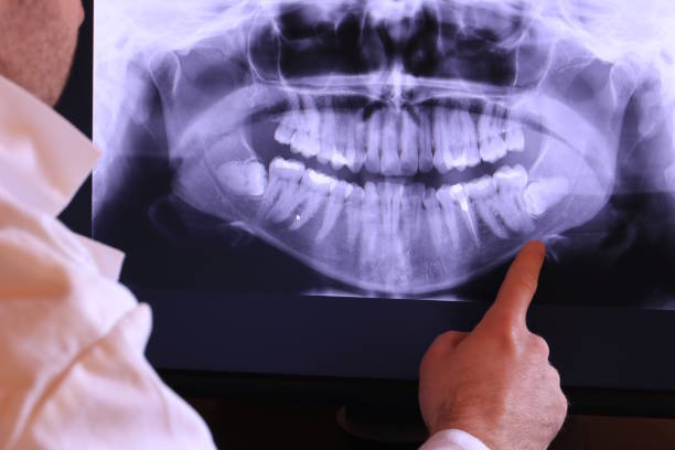 Best Broken or Cracked Tooth Emergency Dentist in Alton, IA